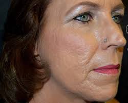 A new nose piercings I have done in the past. My first ever piercing was a  nose piercing, done by my mother and mentor! What was your first piercing?  Got a story