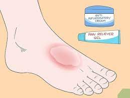 How To Treat Extensor Tendonitis 11 Steps Wikihow