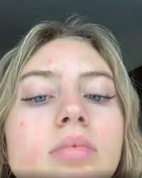 Jun 16, 2021 · immer wieder zeigt sich heidi klum auf instagram ungeschminkt und ganz natürlich, wie hier mit ihrer tochter leni. Starkes Statement Leni Klum Steht Zu Ihren Hautunreinheiten Promiflash De