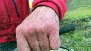 When is midge season in scotland? Estimate Given For Biting Midge Numbers In Highlands Bbc News