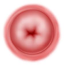 Aku pribadi setidaknya tahu kanker serviks itu penyakit apa. Bab 13 Kanker Serviks Melaka Fertility Selva S Fertility Obstetrics And Gynaecology Clinic