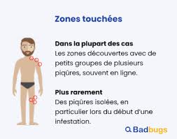 Dictionnaire des synonymes (en français argotique, familier et populaire) / bob, dictionnaire d'argot Piqure Punaise De Lit Photo Badbugs Fr