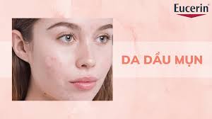 8 Bước Chăm Sóc Da Dầu Mụn Nhanh Chóng Phục Hồi | Eucerin
