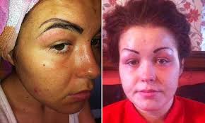 Funny eyebrows thin eyebrows worst eyebrows crazy eyebrows eye brows tattooed eyebrows arched eyebrows makeup eyebrows everything. Woman Looks Like A Clown After Botched Eyebrow Tattoo Fillers Daily Mail Online