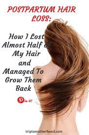 Postpartum Hair Loss The Truth Best Treatments To Make It Stop Postpartum Hair Loss Hair Loss Hair Loss Remedies