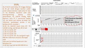 Partograf adalah alat bantu yang di gunakan selama fase aktif persalinan ( depkes ri, 2004). Contoh Soal Partograf Dan Cara Mengerjakannya Youtube