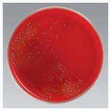 Summary rose agar consists of half columbia cna agar and half phenylethyl alcohol agar base. Remel Columbia Cna W 5 Sheep Blood And Vancomycin 6Âµg Ml
