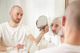 How are hair transplant costs calculated? Why Are Hair Transplants In South Korea Better Than The Usa The Fashionisto
