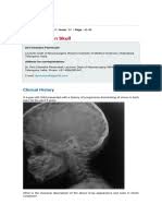 From wikipedia, the free encyclopedia copper beaten skull is a phenomenon wherein intense intracranial pressure disfigures the internal surface of the skull. The Copper Beaten Skull Pdf Skull Medical Specialties