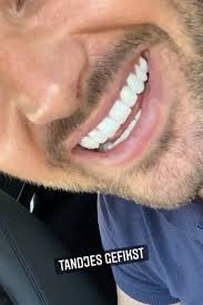 Voor die facings heeft hij zijn originele gebit moeten slopen. Geen Paniek Parelwitte Tanden Van Dave Roelvink Weer Gefixt Rtl Boulevard