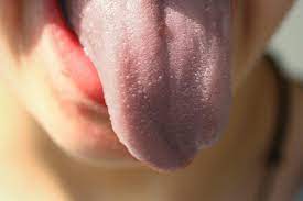 Check spelling or type a new query. Limba Alba Oglinda Sanatatii Tale Clinica Excedent