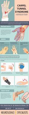 The doctor will examine your hands for swelling and other symptoms. Carpal Tunnel Syndrome A Detailed Study