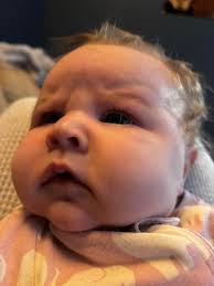 Hey mamas I'm a ftm to an 8 week old baby girl and today noticed she's has  eye boogers in her eye, from what I've read it seems to be a blocked
