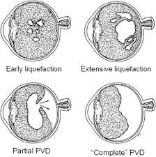 Adult vitreous structure and postnatal changes | Eye