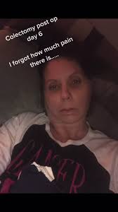 colectomy #cancerwarrior #colonsurgery #fyp #2021goals🦋