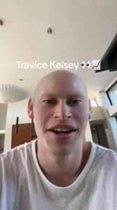 Brooo!‼️ #chiefs #ravens #superbowl