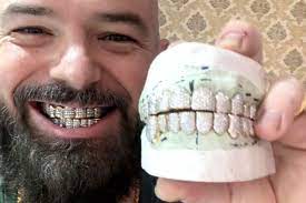 How To Design Grillz With Paul Wall Grillz Paul Wall How To Get Money