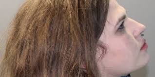 Worcester woman charged for attacking man who backed out of buying sex