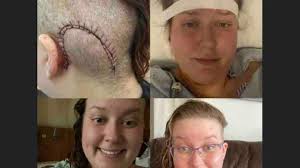 Fundraiser by Stacey Collins : Help with Stacey's Medical Expenses