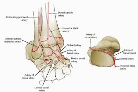 Image result for Talus Fracture