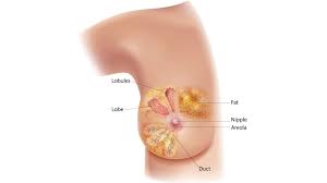 Image result for Breast Cancer