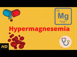 Image result for Hypermagnesemia