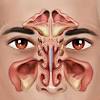 Hidung tersumbat merupakan gejala dari suatu penyakit. 1