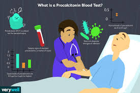 Check spelling or type a new query. Procalcitonin Blood Test Results And What They Mean
