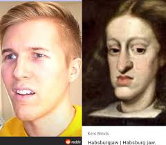 The habsburg jaw, which is also known as the habsburg lip, is one of the most common genetic disorders found in royal families. Meme Made Drewdurnil