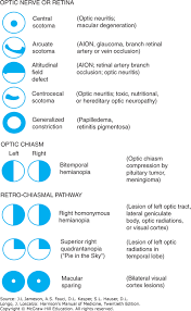 Image result for Acute Vision Loss