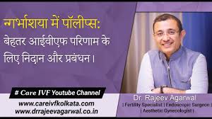 Endometrial Polyp Symptoms Diagnosis And Management Hindi Youtube