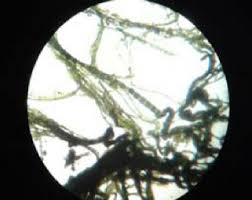 Pond water under microscope labeled. Microscopic View Of Spirogyra Sp Download Scientific Diagram