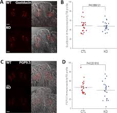 Maybe you would like to learn more about one of these? The Wt1 Basp1 Complex Is Required To Maintain The Differentiated State Of Taste Receptor Cells Life Science Alliance
