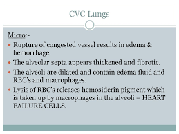 To find out how cvc units are translating corporate resources into smart capital for sponsored ventures. Cvc Lung Liver And Spleen Ppt Video Online Download