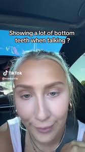 Upper Teeth Cover over Bottom Teeth Talker