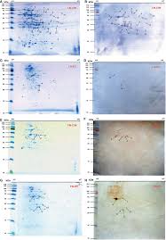 Rita mendes is the author of incoerências (4.00 avg rating, 1 rating, 1 review, published 2018). Frontiers Corrigendum Identification Of Novel Laminin And Fibronectin Binding Proteins By Far Western Blot Capturing The Adhesins Of Streptococcus Suis Type 2 Cellular And Infection Microbiology