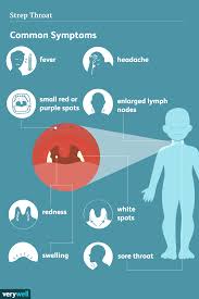 Image result for Strep throat infection roof of mouth