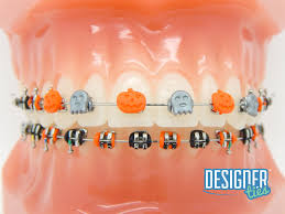 Gray (or shiny metallic silver, if it's available). G H Orthodontics