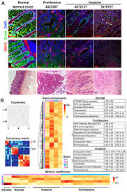 Homeopathy as a natural option for dog cancer as always with a view to holistic dog cancer treatments, homeopathy has its role to play. Cancers Free Full Text Proliferative And Invasive Colorectal Tumors In Pet Dogs Provide Unique Insights Into Human Colorectal Cancer