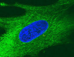 During this part of the cell cycle the cell grows and the interphase. Interphase Humangenetisches Glossar Knw Kindernetzwerk E V