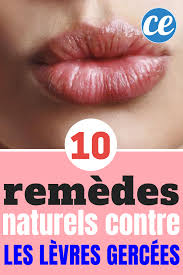Voici 10 Remedes Naturels Pour Soigner Et Proteger Les Levres Gercees Et Seches Levres Gercees Levre Soin Levres