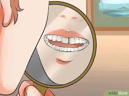 Can teeth gaps be closed without braces. How To Get Rid Of Gaps In Teeth 14 Steps With Pictures