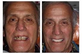 Before & After Photos