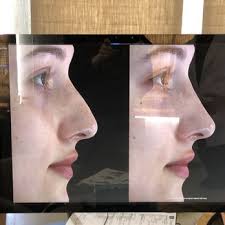 RICHARD ELLENBOGEN, MD