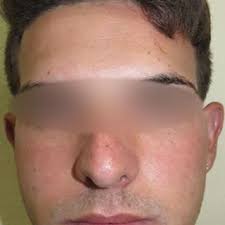 Denia MORALES NAVARRO