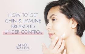 How do you get rid of pimples in an hour? Prevent Chin Acne Pimples On Your Chin With These Tips Renee Rouleau
