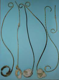 This string may be used to remove the stent later on. Management Of Encrusted Ureteral Stents Sciencedirect
