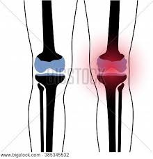 2006 kia optima belt diagram. X Ray Normal Knee Vector Photo Free Trial Bigstock
