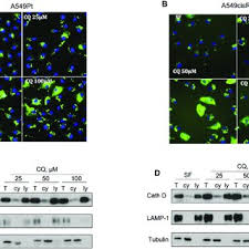 An example of a specific vesicle that is critical for cellular life and produced in the golgi is a lysosome. Pdf Modulating Lysosomal Function Through Lysosome Membrane Permeabilization Or Autophagy Suppression Restores Sensitivity To Cisplatin In Refractory Non Small Cell Lung Cancer Cells