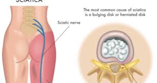 Pin On Health